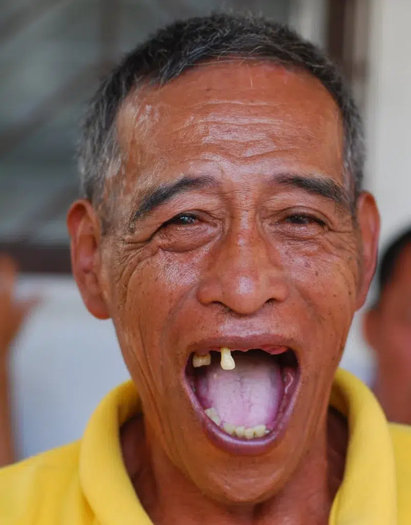 Swallowing, Lingual papillae, Mucous membrane, documentary photography by Josh Edelson/AFP
